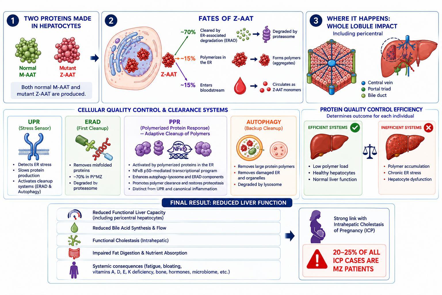 Figure 1: normal M-AAT and mutant Z-AAT production in hepatocytes; Z-AAT degradation, polymerization and secretion; whole-lobule impact, cellular quality control, reduced liver function and downstream effects.